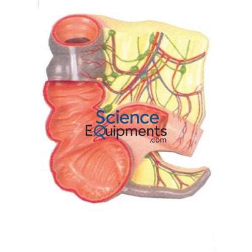 Appendix and Caecum 2X Mag