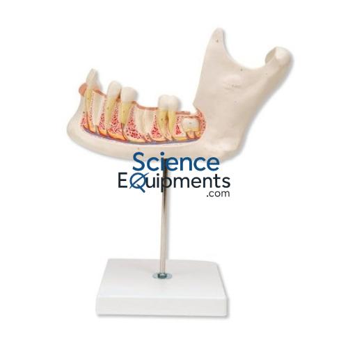 Jaw Model, Lower 3X Mag 6Pc